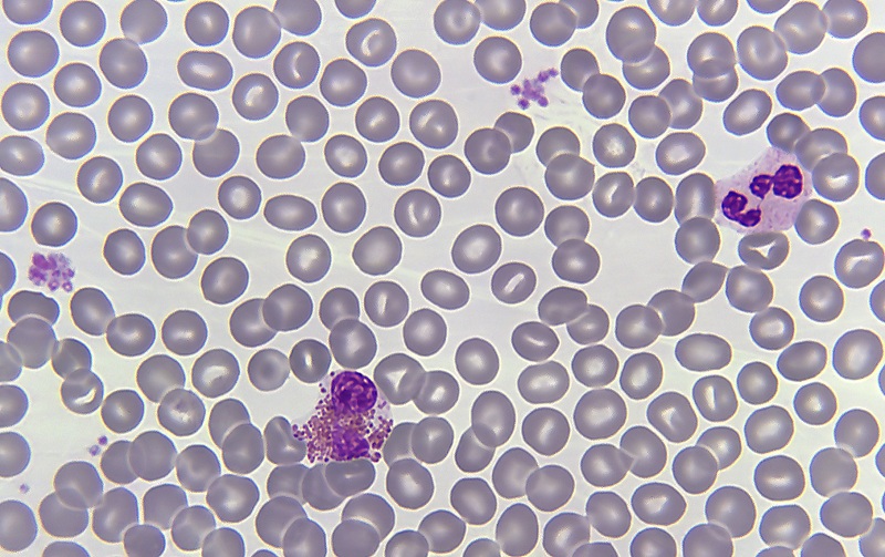bloed in urine oorzaak DrBeckmann bloed in urine oorzaak DrBeckmann